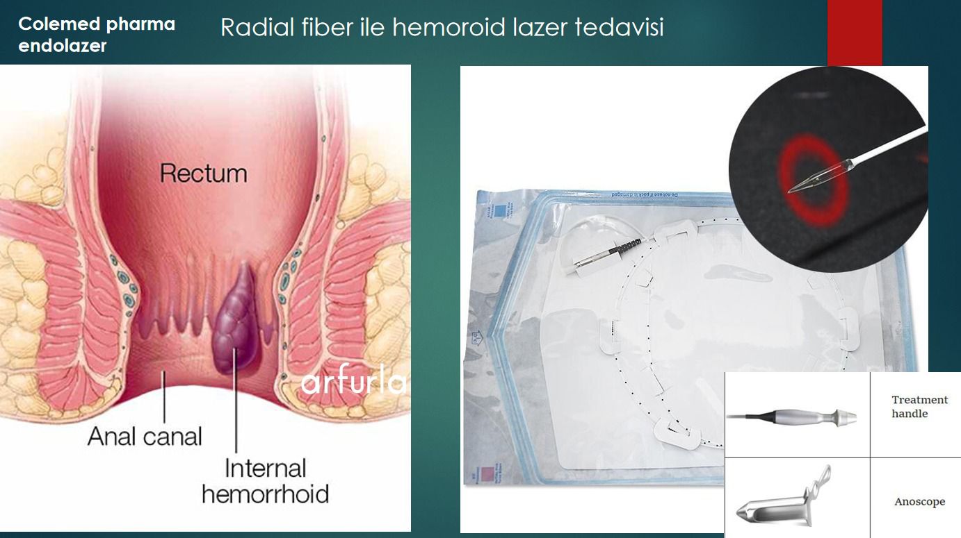 Hemoroid başlığı